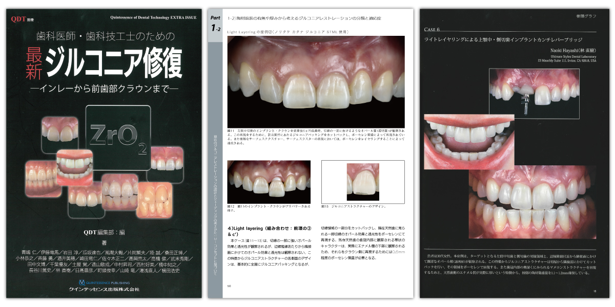 林直樹がQDT別冊に掲載